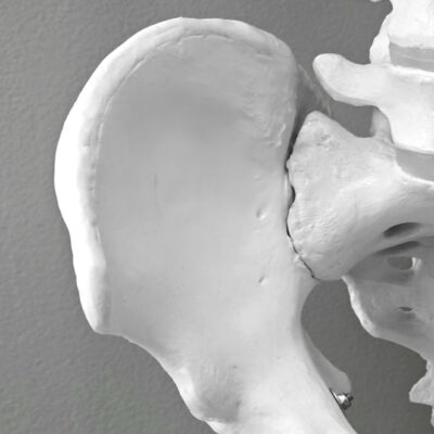 Osteoporosis